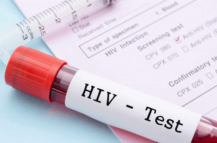 QUY TRÌNH XÉT NGHIỆM HIV THỰC HIỆN NHƯ THẾ NÀO? 