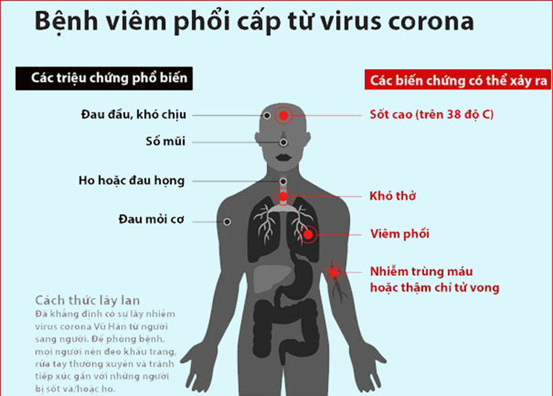 Triệu chứng của virus corona mới ở Vũ Hán là gì?