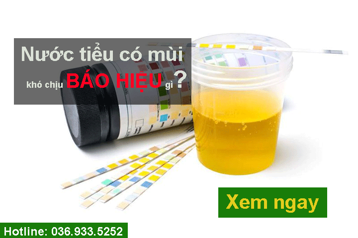 Nước tiểu có mùi lạ khó chịu báo hiệu gì ?